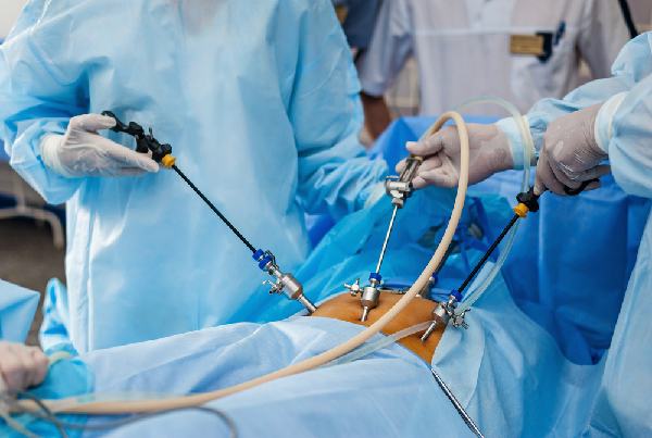 Laparoscopic Surgery