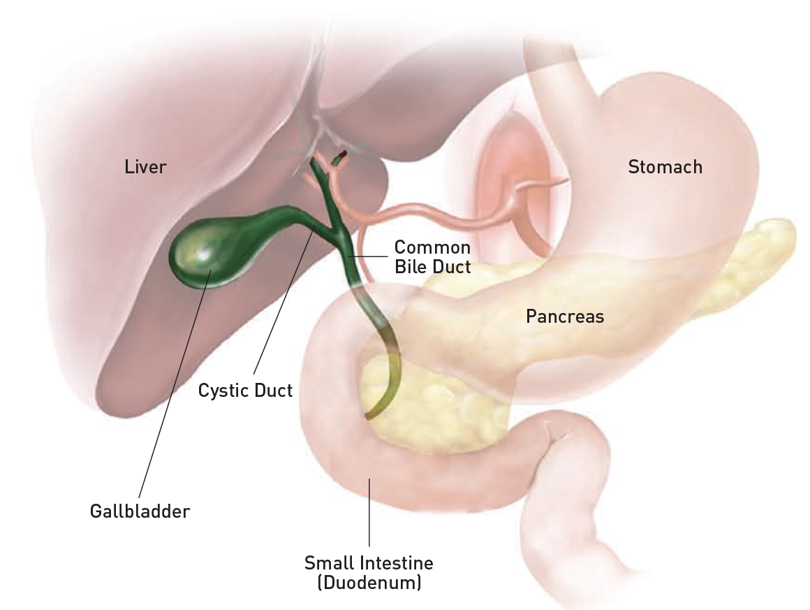 Laparoscopic Cholecystectomy