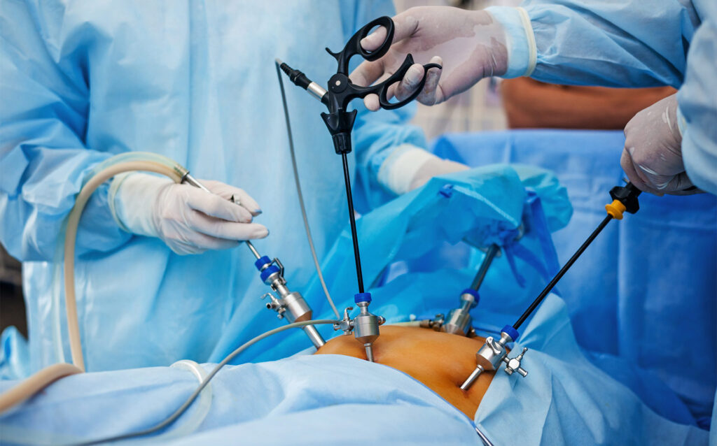 Bariatric Surgery in Dwarka