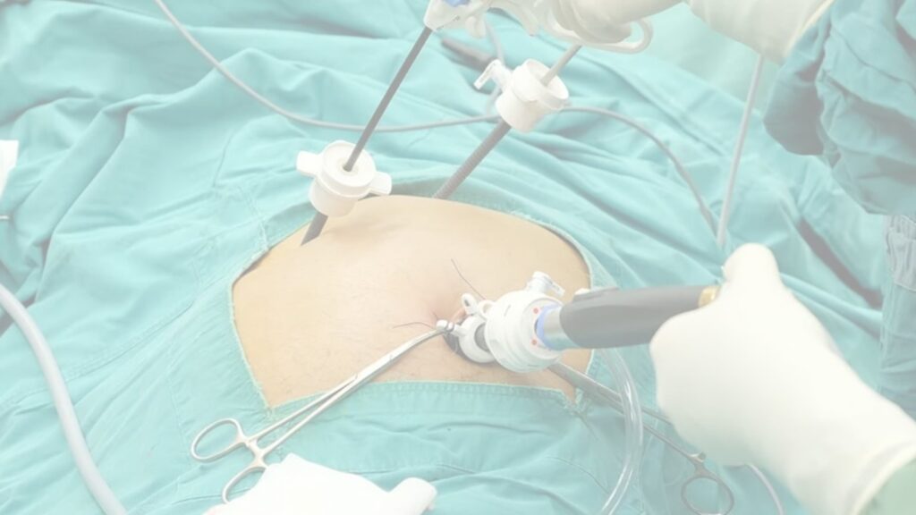 Bariatric surgeon in Dwarka